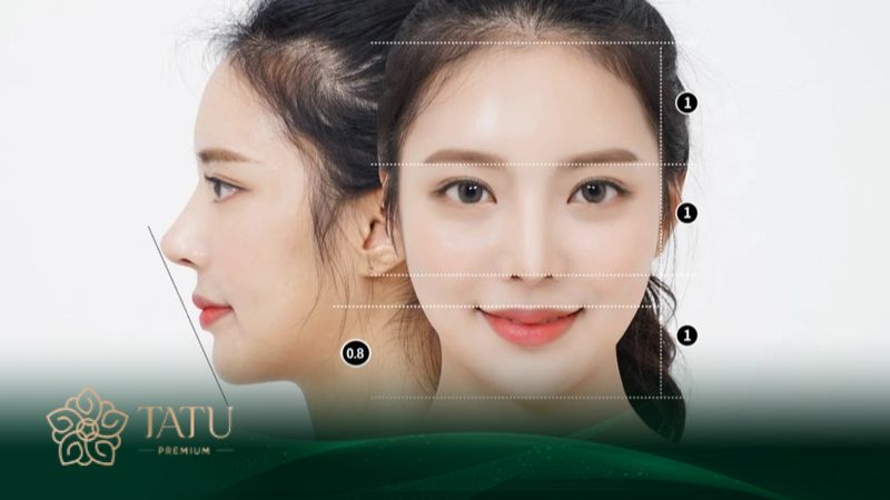 Thời gian duy trì dáng cằm sau độn ảnh hưởng bởi rất nhiều yếu tố