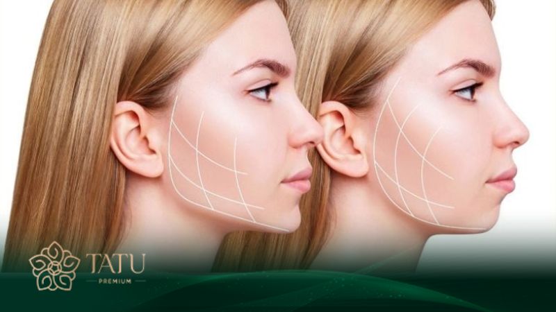 Cô Ngân của Viện thẩm mỹ Tatu Premium nổi tiếng trong lĩnh vực độn cằm phong thủy