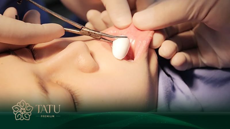 Chăm sóc hậu phẫu sai cách ảnh hưởng rất nhiều đến kết quả chỉnh dáng cằm