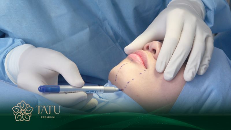 Lựa chọn cơ sở nâng cằm để tránh rủi ro không mong muốn