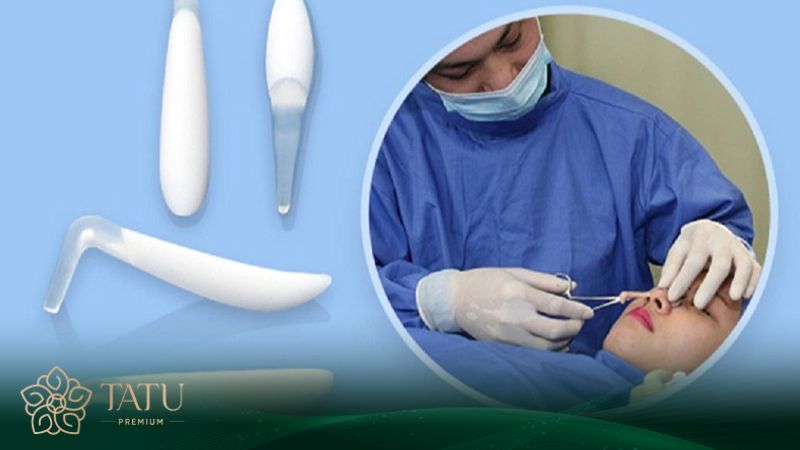Các loại sụn nâng mũi được ưa chuộng