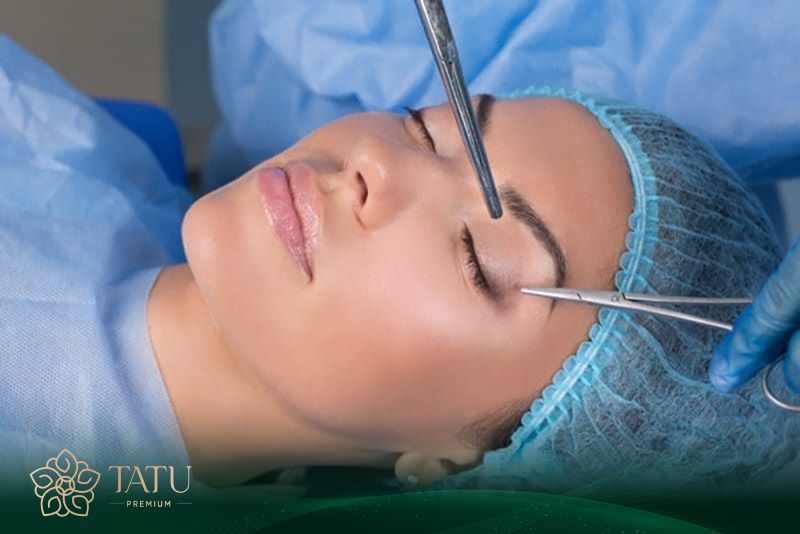 Cắt mí mắt không gây đau đớn vì khách hàng được sử dụng thuốc tê.