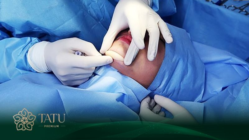 Bác sĩ tại Viện thẩm mỹ Tatu Premium giỏi chuyên môn, kinh nghiệm