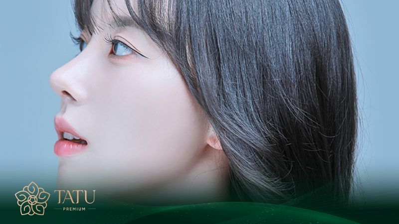Nâng mũi S line giá bao nhiêu tiền? Từ 20.000.000 - 100.000.000 VNĐ