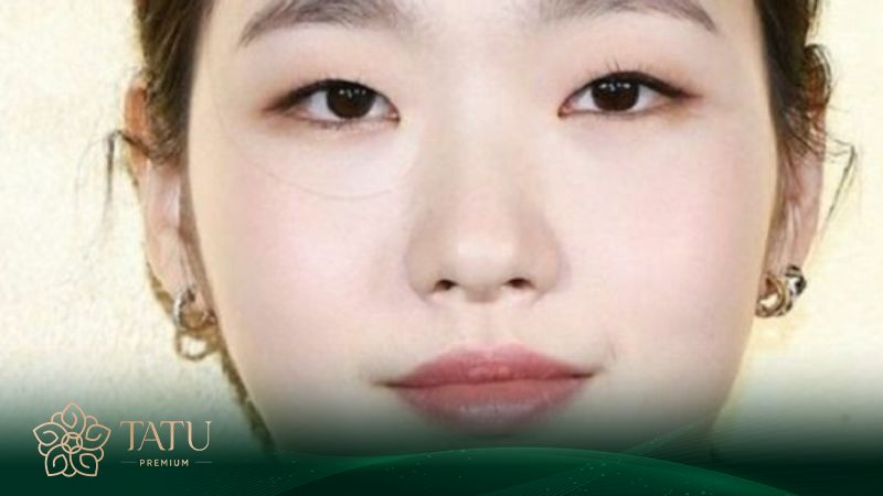 Các tướng mũi cần can thiệp thẩm mỹ phong thủy