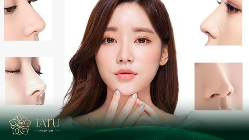 Nâng mũi S line là lựa chọn của nhiều gia chủ khi quyết định thẩm mỹ