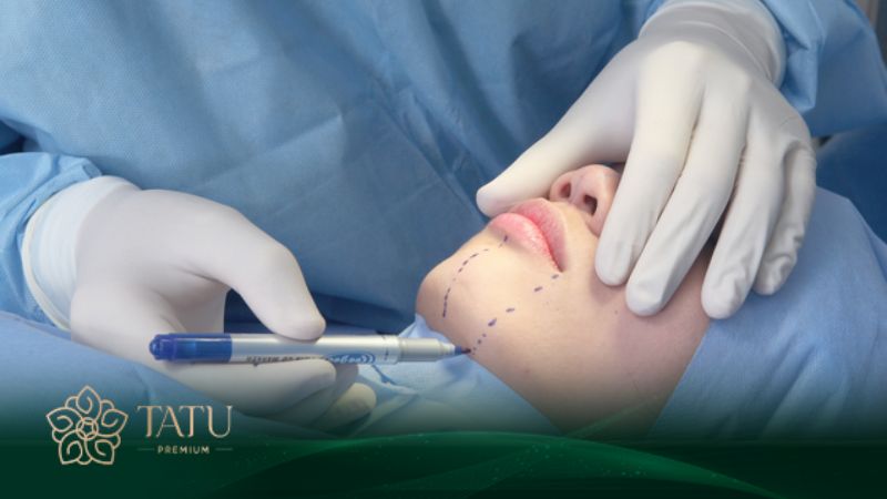 Nâng cằm là phương pháp đơn giản giúp thay đổi dáng cằm như ý