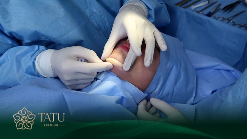 Chất liệu sụn khác nhau chi phí tạo hình dáng cằm cũng khác nhau