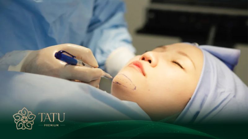 Nâng cằm thẩm mỹ chỉnh dáng cằm đẹp tạo vẻ đẹp hài hòa cho gương mặt