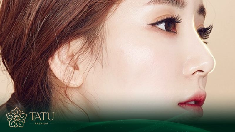 Nâng mũi sụn tự thân không còn xa lạ với giới thẩm mỹ