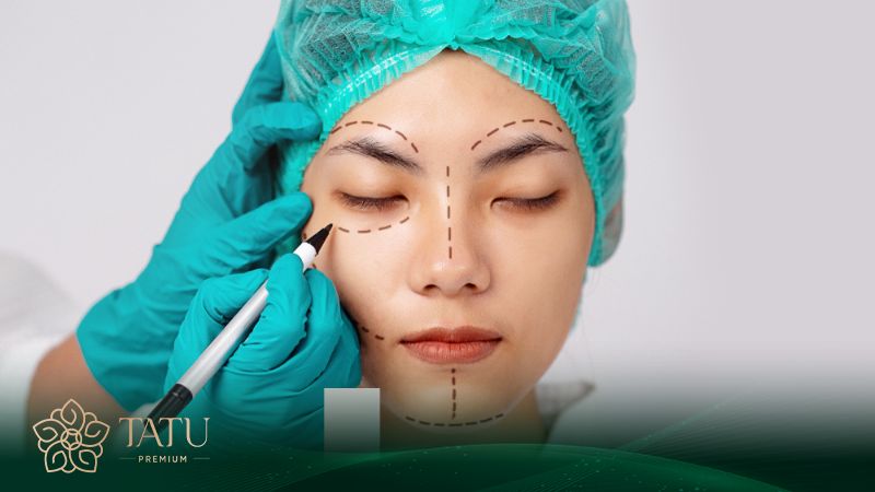 Chi tiết các bước trong quy trình nâng mũi S line