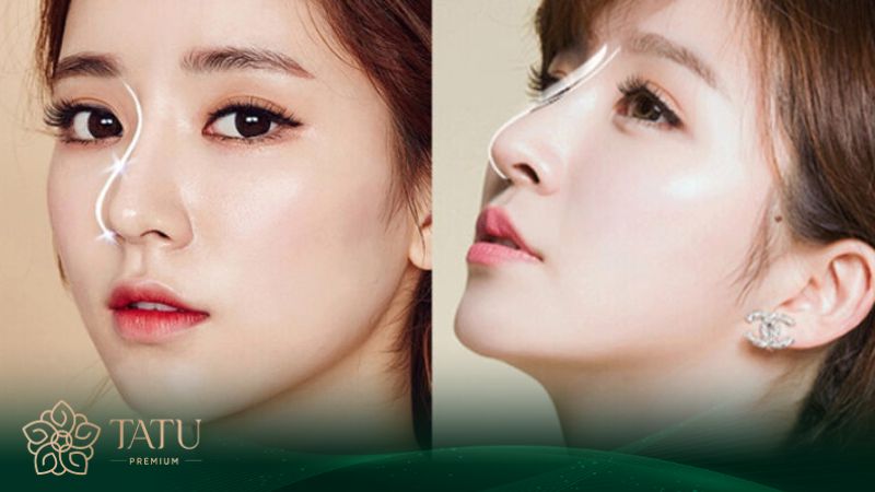 Mỗi loại sụn đều sở hữu những ưu, nhược điểm riêng