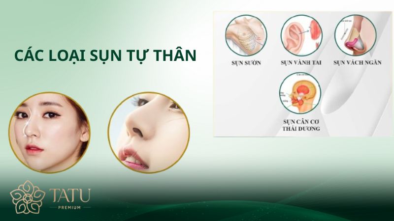 Các loại sụn nâng mũi tự thân