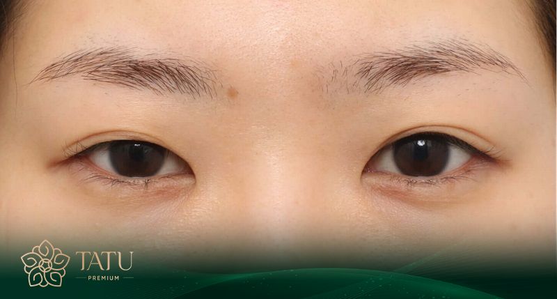 mắt to mắt nhỏ lại báo hiệu một tương lai thiếu ổn định, an toàn và đầy rẫy rủi ro.