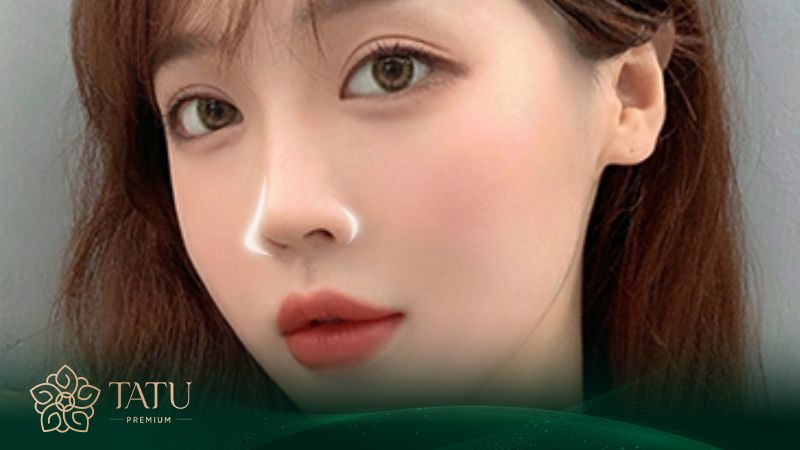 Giải pháp cho người mũi gặp ít khuyết điểm