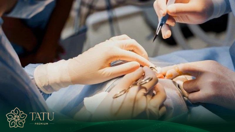 Tay nghề là yếu tố quan trọng quyết định giá nâng mũi