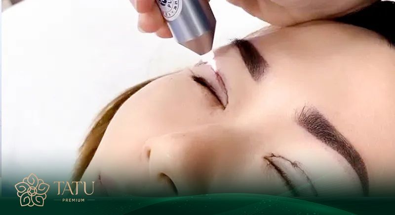 Cắt mí mắt là một tiểu phẫu thẩm mỹ, trong đó bác sĩ rạch một đường nhỏ ở mí trên hoặc mí dưới.
