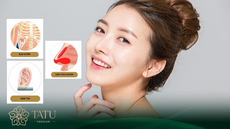 Nâng mũi bằng sụn tự thân gồm sụn mũi, sụn tai và sụn sườn