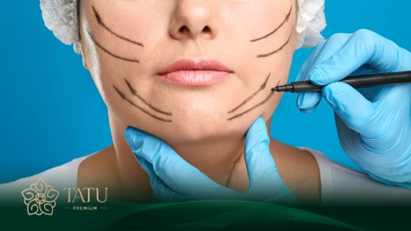 Phẫu thuật gọt cằm Vline tự nhiên, cân đối, nâng tầm nhan sắc