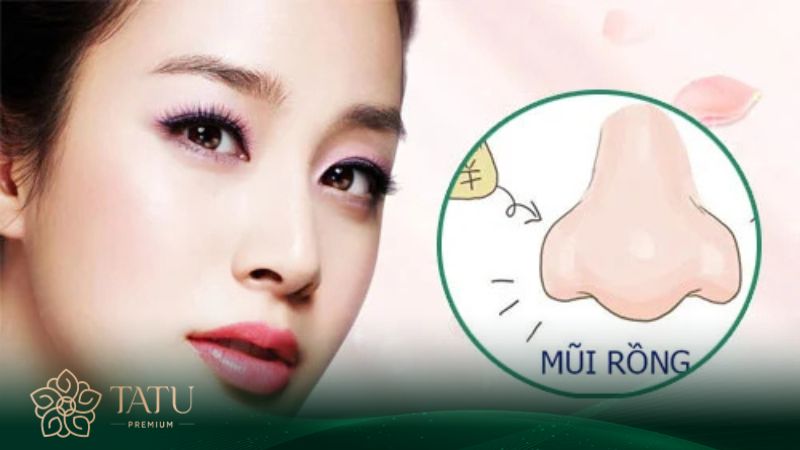 Các tướng mũi được cho là không nên sửa theo phong thủy