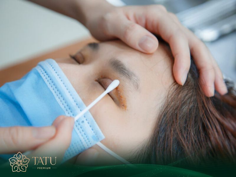 Vệ sinh bằng nước muối và dung dịch sát khuẩn chuyên dụng